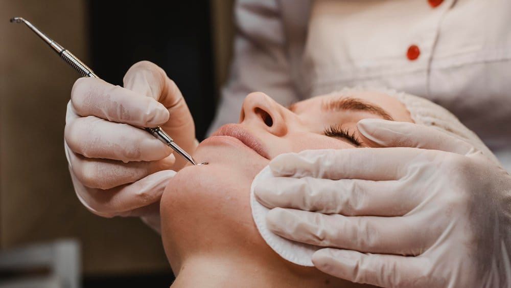 Perawatan wajah di C Derma