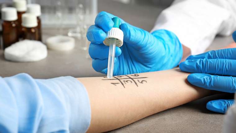 Skin Allergic Test