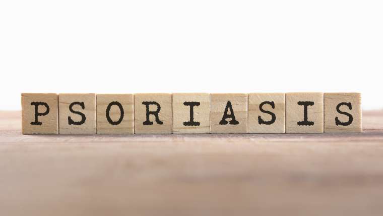 Apa Itu Psoriasis? Temukan Jawabannya Disini