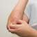 Perbedaan Dermatitis Seboroik dan Psoriasis!