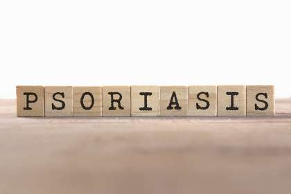 Psoriasis,Word,Written,In,Wooden,Cube Perawatan Laser Dapat Mengobati Psoriasis?