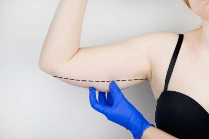 perawatan body contouring