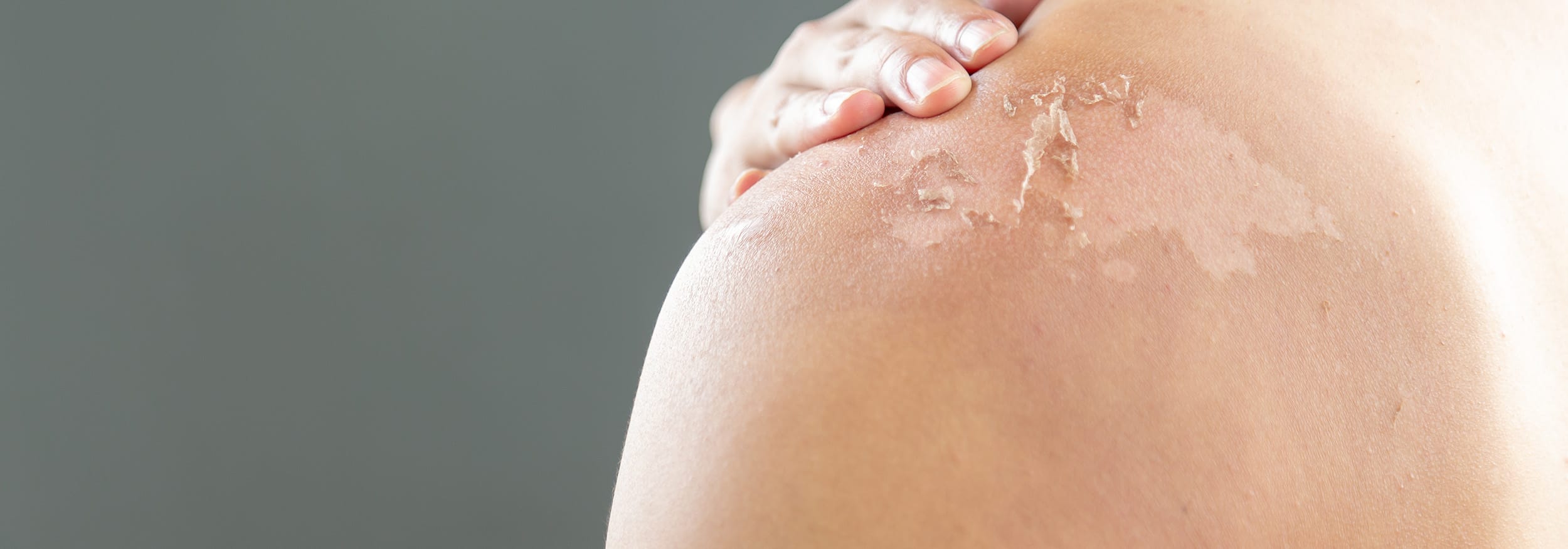 sensitive skin new 2