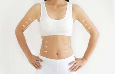 jenis perawatan body contouring