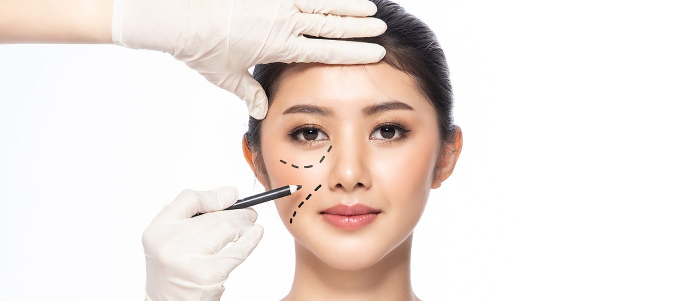 Thread Lift / tanam benang membuat wajah terlihat kencang