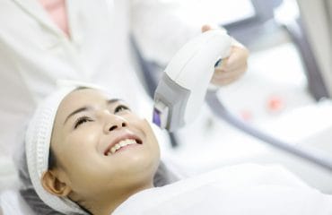 Perawatan Laser Vaskular Atasi Gangguan Pembuluh Darah