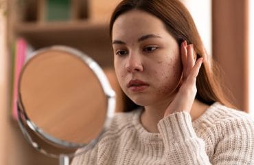 Kenali Sel Kulit Mati di Wajah, Penyebab hingga Cara Mengatasinya