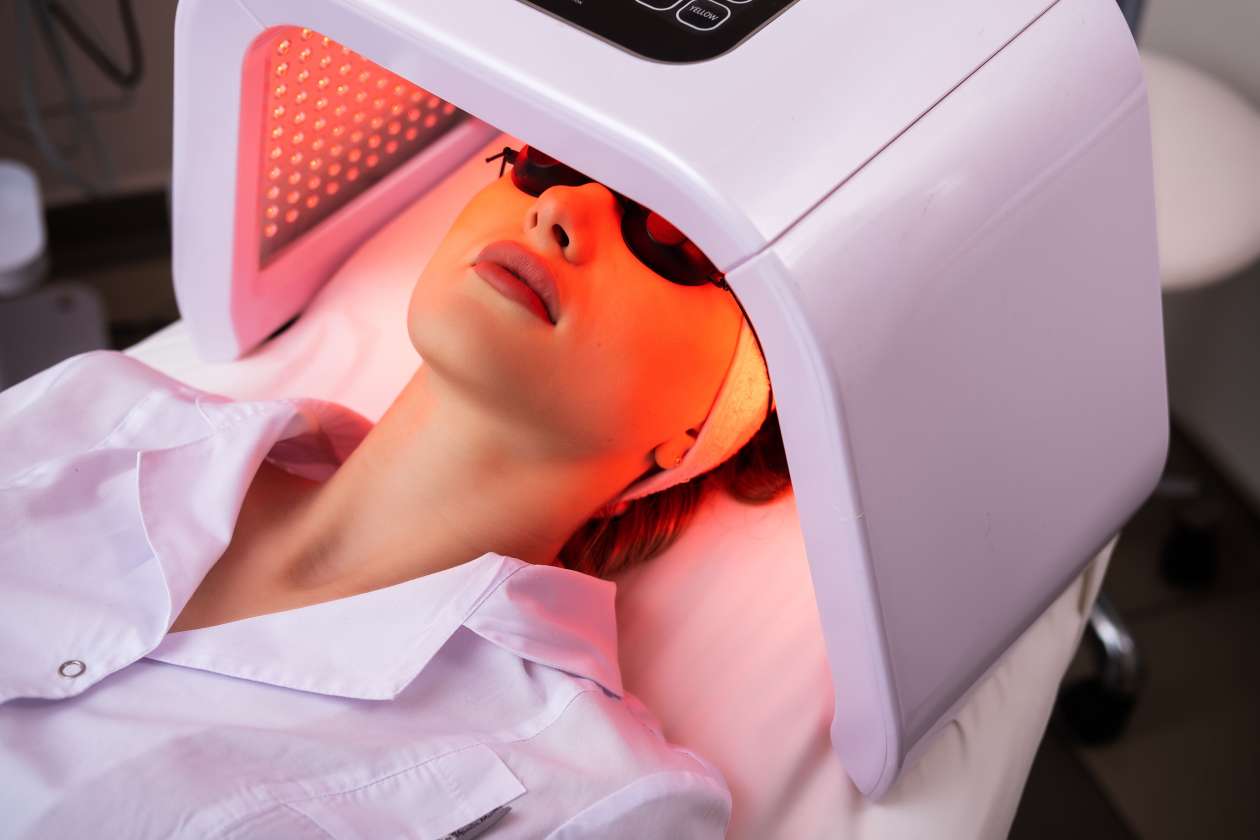 Cara Mengobati Vitiligo dengan Phototherapy Laser
