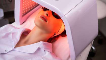Cara Mengobati Vitiligo dengan Phototherapy Laser