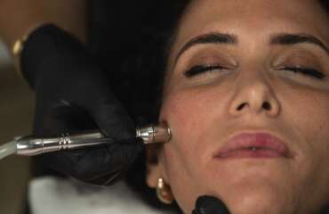Diamond Tip Handpiece Microdermabrasion