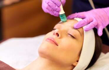 Crystal Microdermabrasion